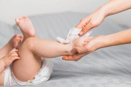 Diaper Rash Solutions Every Parent Should Know!